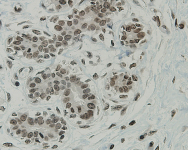 CCDC47 Antibody in Immunohistochemistry (Paraffin) (IHC (P))