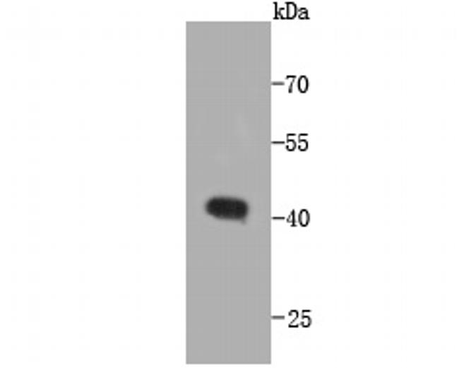 CCDC47 Antibody in Western Blot (WB)