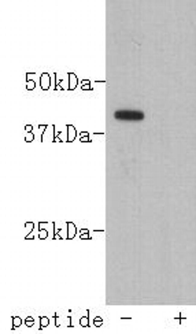 Lass2 Antibody in Western Blot (WB)