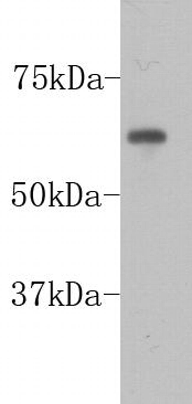PGBD5 Antibody in Western Blot (WB)