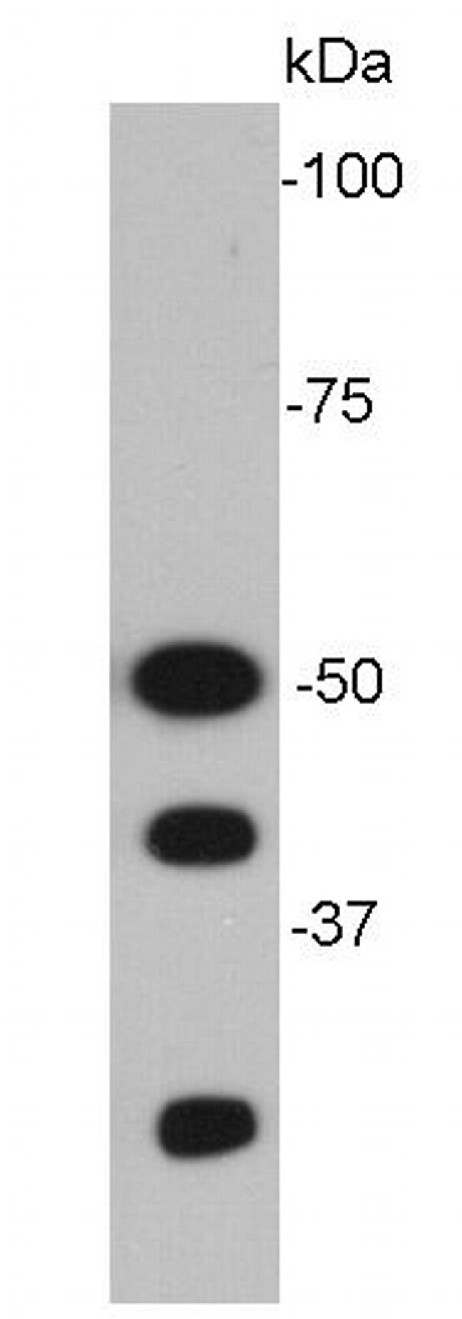 NFkB p50/p105 Antibody in Western Blot (WB)