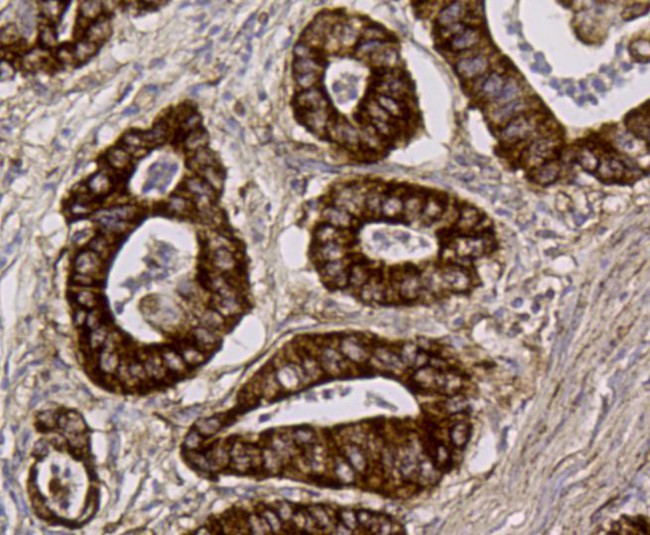 ALDH2 Antibody in Immunohistochemistry (Paraffin) (IHC (P))