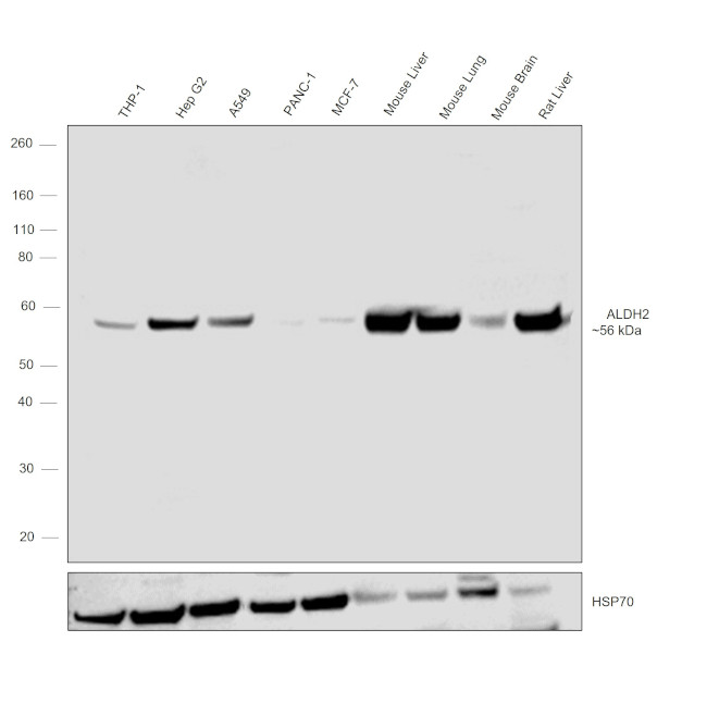 ALDH2 Antibody