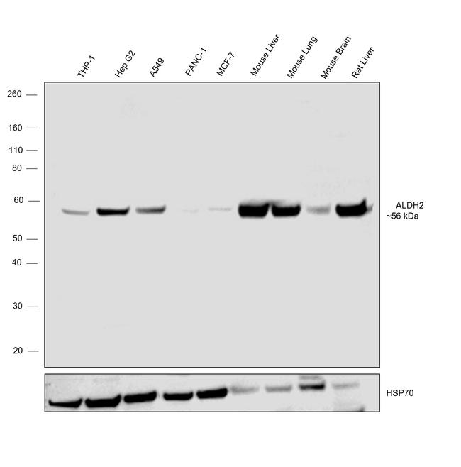 ALDH2 Antibody in Western Blot (WB)