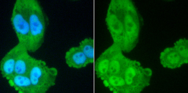 PP2A alpha/beta Antibody in Immunocytochemistry (ICC/IF)