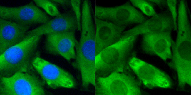 PP2A alpha/beta Antibody in Immunocytochemistry (ICC/IF)