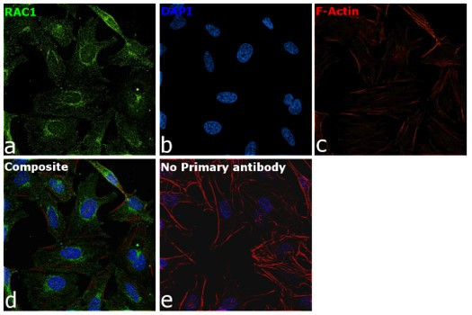 RAC1 Antibody in Immunocytochemistry (ICC/IF)