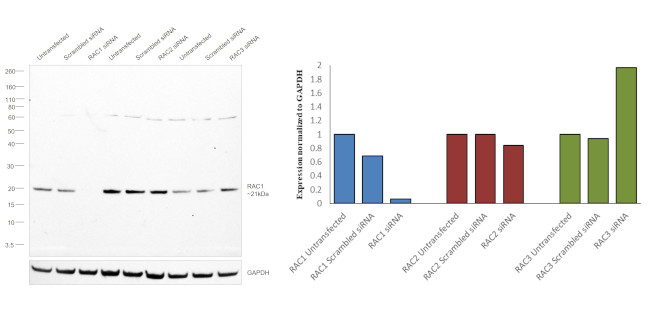 RAC1 Antibody in Western Blot (WB)