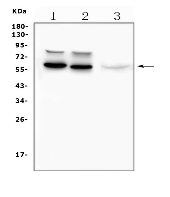 Tyrosine Hydroxylase Antibody in Western Blot (WB)