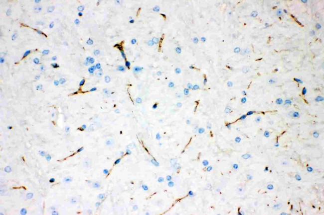 Tyrosine Hydroxylase Antibody in Immunohistochemistry (Paraffin) (IHC (P))