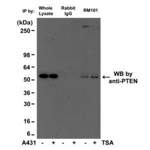 Acetylated Lysine Antibody in Immunoprecipitation (IP)