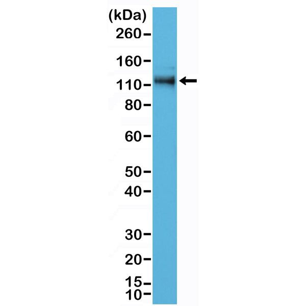 delta Catenin Antibody in Western Blot (WB)