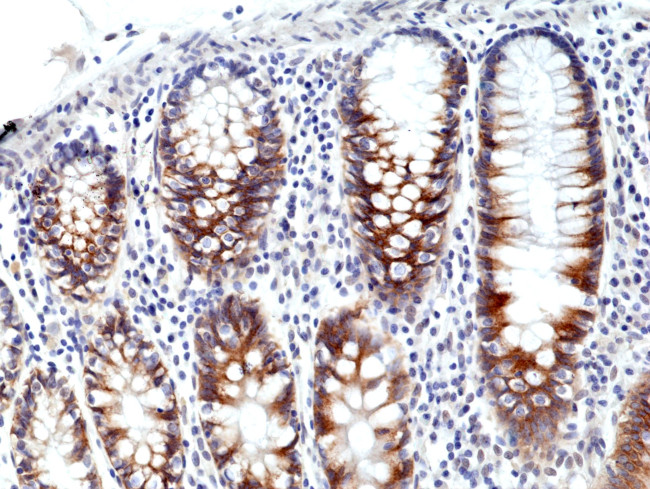 CD71 (Transferrin Receptor) Recombinant Monoclonal Antibody (RM384