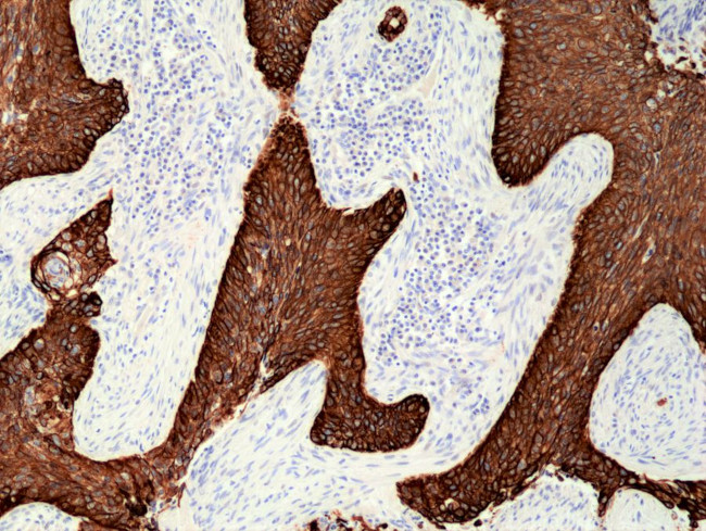 Cytokeratin 5/6 Antibody in Immunohistochemistry (Paraffin) (IHC (P))