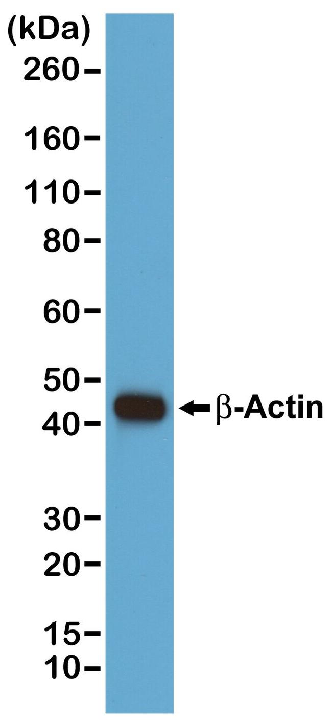 beta Actin Recombinant Monoclonal Antibody (RM112) (MA5-33078)