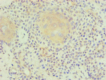 PLA2G7 Antibody in Immunohistochemistry (Paraffin) (IHC (P))