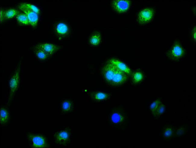 Caspase 9 Antibody in Immunocytochemistry (ICC/IF)