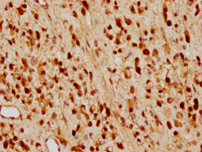 p27 Kip1 Antibody in Immunohistochemistry (Paraffin) (IHC (P))