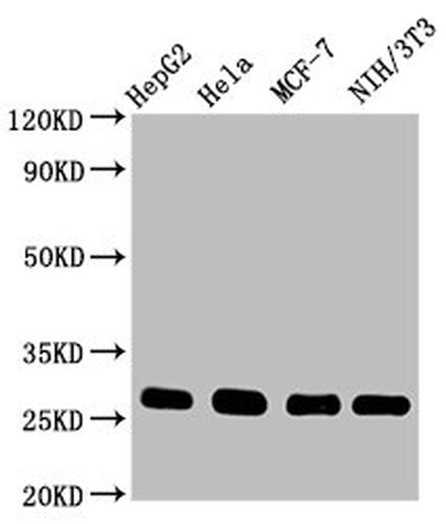 p27 Kip1 Antibody in Western Blot (WB)