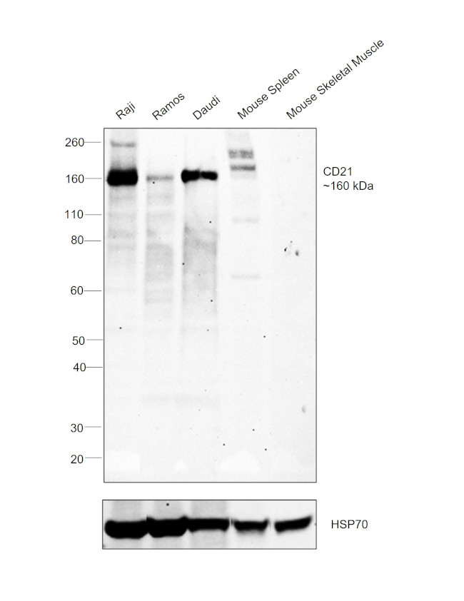 CD21 Antibody in Western Blot (WB)