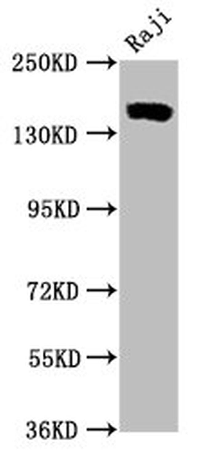 CD21 Antibody in Western Blot (WB)