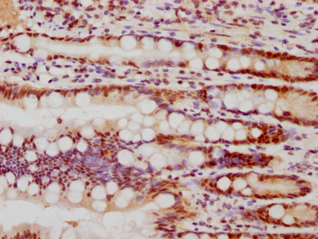 FEN1 Antibody in Immunohistochemistry (Paraffin) (IHC (P))