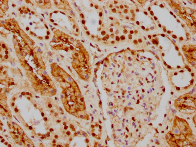 HDAC9 Antibody in Immunohistochemistry (Paraffin) (IHC (P))