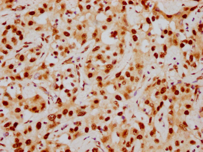 HDAC9 Antibody in Immunohistochemistry (Paraffin) (IHC (P))