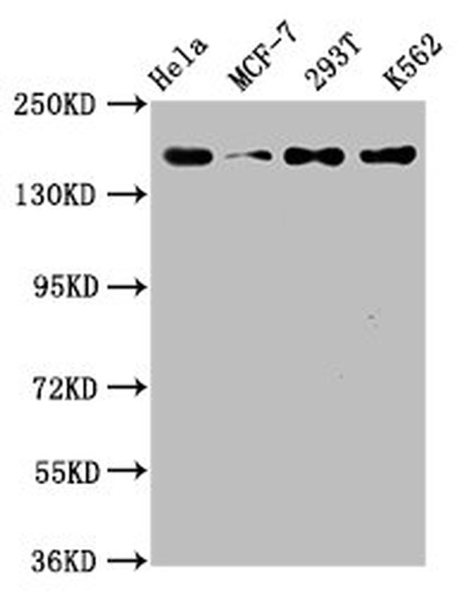 HDAC9 Antibody in Western Blot (WB)