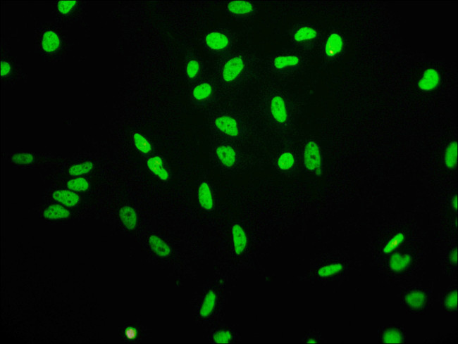 H3K4ac Antibody in Immunocytochemistry (ICC/IF)