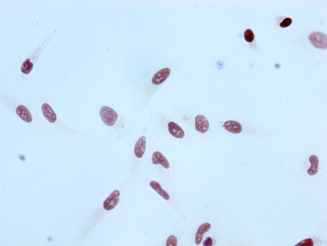 H3K4ac Antibody in Immunocytochemistry (ICC/IF)