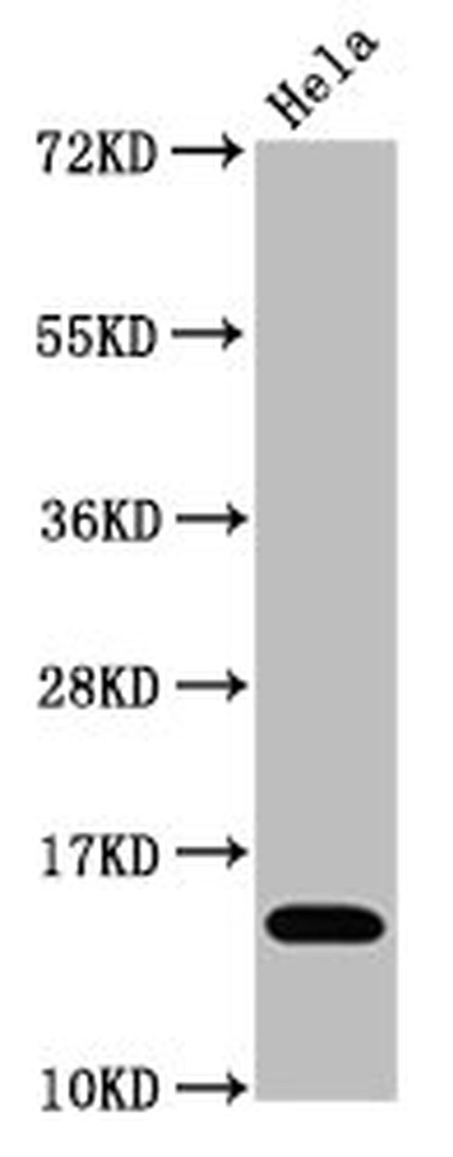 H3K4ac Antibody in Western Blot (WB)