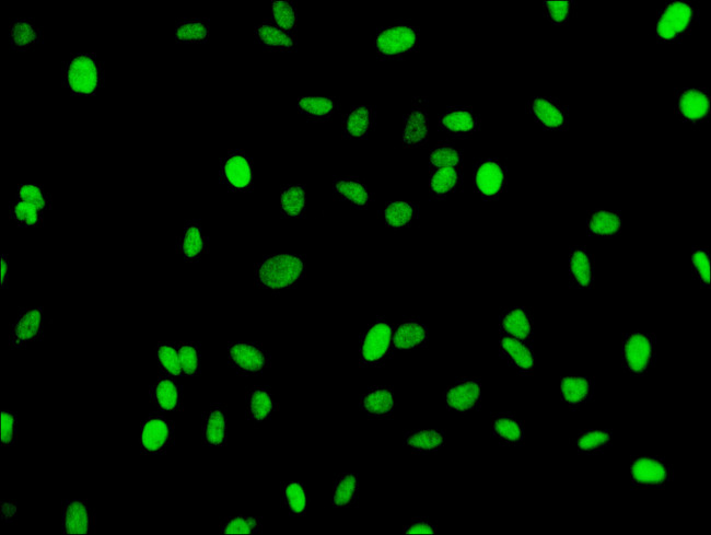 H3K18me1 Antibody in Immunocytochemistry (ICC/IF)