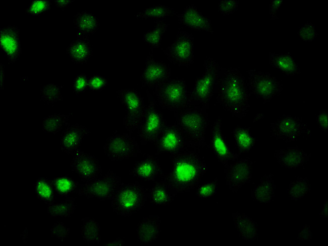 Phospho-AMPK alpha-2 (Thr172) Antibody in Immunocytochemistry (ICC/IF)