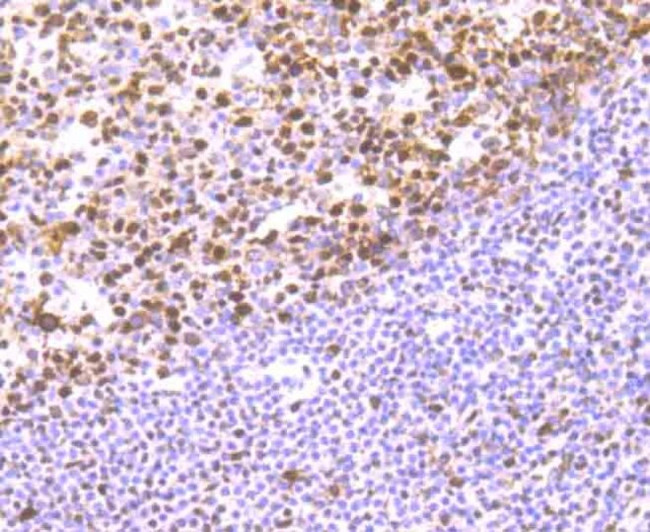 RbAp48 Antibody in Immunohistochemistry (Paraffin) (IHC (P))