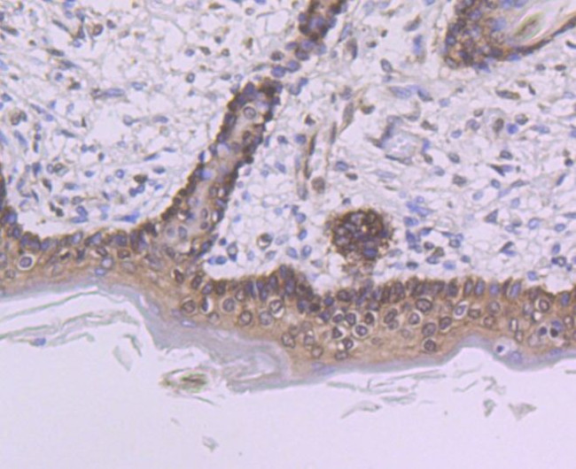 PTBP1 Antibody in Immunohistochemistry (Paraffin) (IHC (P))