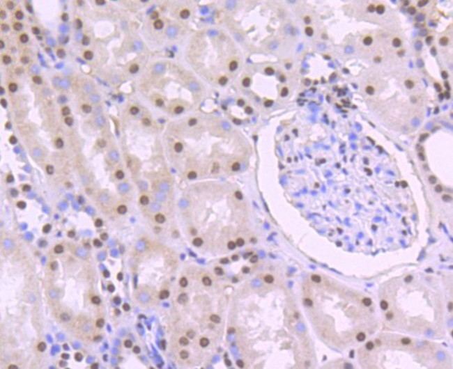 PTBP1 Antibody in Immunohistochemistry (Paraffin) (IHC (P))