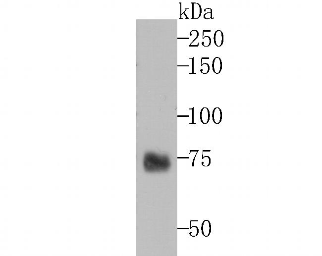 TYRP1 Antibody in Western Blot (WB)