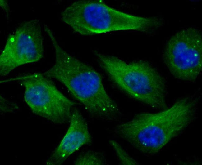 CAS Antibody in Immunocytochemistry (ICC/IF)