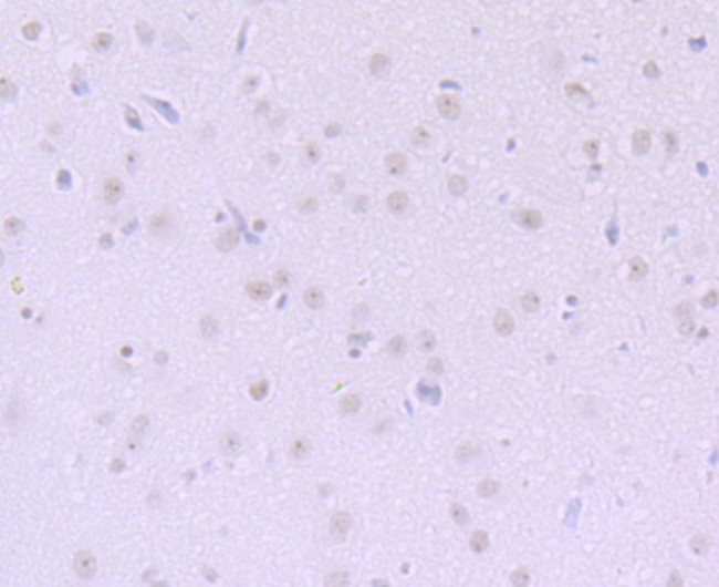 DKC1 Antibody in Immunohistochemistry (Paraffin) (IHC (P))