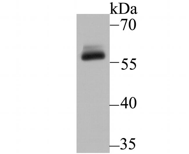 DKC1 Antibody in Western Blot (WB)