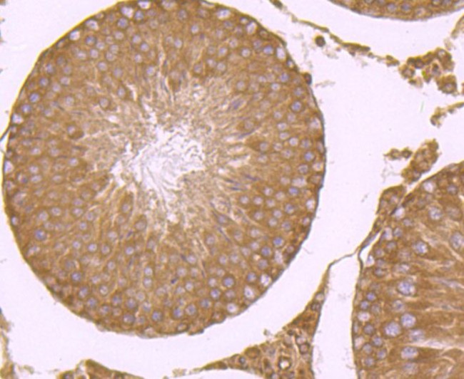 RPS19 Antibody in Immunohistochemistry (Paraffin) (IHC (P))