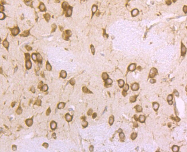 RPS19 Antibody in Immunohistochemistry (Paraffin) (IHC (P))