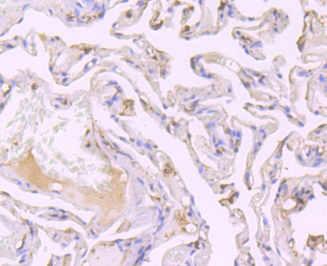 SRC1 Antibody in Immunohistochemistry (Paraffin) (IHC (P))