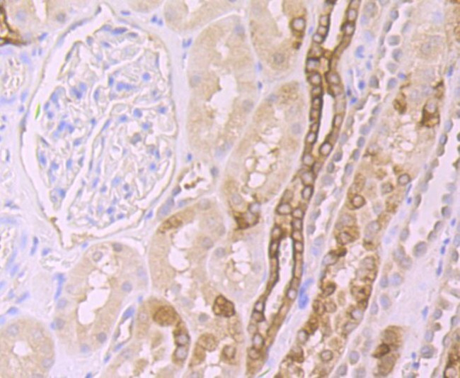 FZD8 Antibody in Immunohistochemistry (Paraffin) (IHC (P))