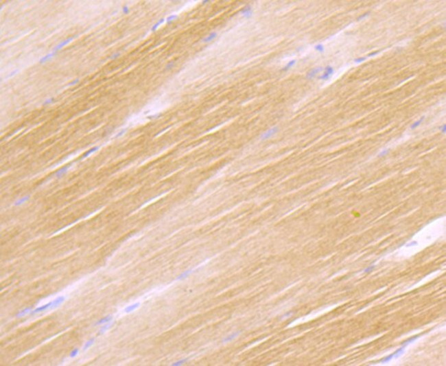 H-cadherin Antibody in Immunohistochemistry (Paraffin) (IHC (P))