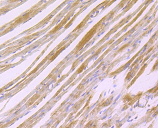 H-cadherin Antibody in Immunohistochemistry (Paraffin) (IHC (P))