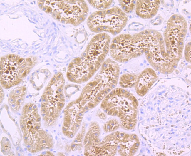 H-cadherin Antibody in Immunohistochemistry (Paraffin) (IHC (P))