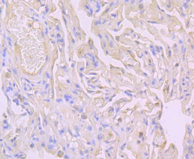 Flotillin 1 Antibody in Immunohistochemistry (Paraffin) (IHC (P))