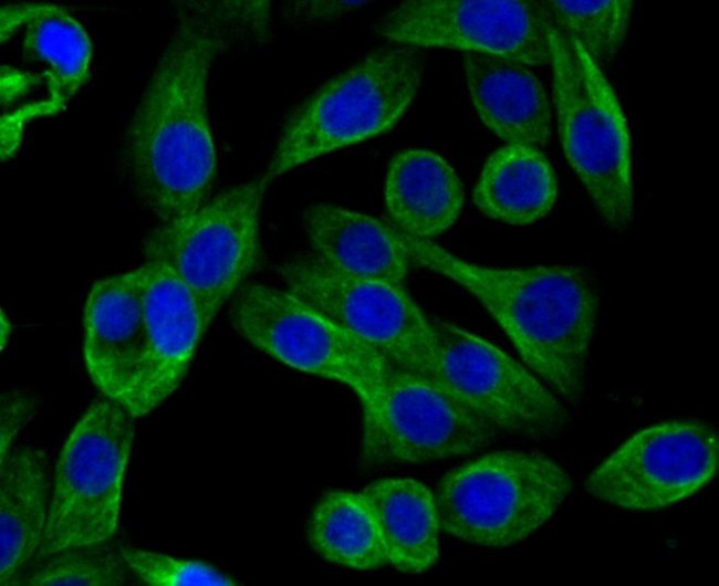 Arp3 Antibody in Immunocytochemistry (ICC/IF)